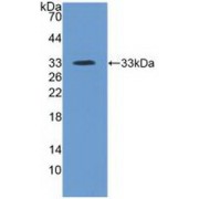 Western blot analysis of recombinant Human ITIH4.