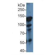 Western blot analysis of Rat Lung lysate, using Rat ITIH4 Antibody (1 µg/ml) and HRP-conjugated Goat Anti-Rabbit antibody (<a href="https://www.abbexa.com/index.php?route=product/search&amp;search=abx400043" target="_blank">abx400043</a>, 0.2 µg/ml).