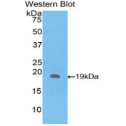 Western blot analysis of the recombinant protein.