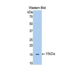 Interleukin 13 Receptor Alpha 2 (IL13Ra2) Antibody