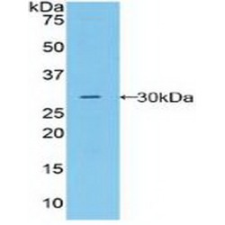 Macrophage Stimulating 1 Receptor (MST1R) Antibody