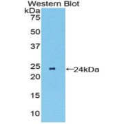 Western blot analysis of the recombinant protein.