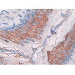 Macrophage Stimulating 1 Receptor (MST1R) Antibody