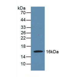 Myelin Oligodendrocyte Glycoprotein (MOG) Antibody