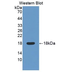 Myelin Oligodendrocyte Glycoprotein (MOG) Antibody