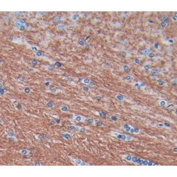 Myelin Oligodendrocyte Glycoprotein (MOG) Antibody