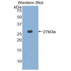 Natural Killer Cell Receptor 2B4 (NKR2B4) Antibody