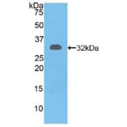 Related To Receptor Tyrosine Kinase (RYK) Antibody