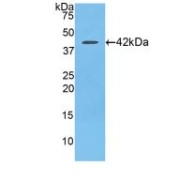 Western blot analysis of recombinant Rat C-C Motif Chemokine 21.