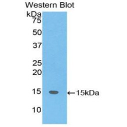 SH2 Domain Containing Protein 1A (SH2D1A) Antibody