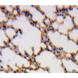 SH2 Domain Containing Protein 1A (SH2D1A) Antibody