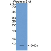 Western blot analysis of the recombinant protein.