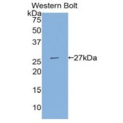 Western blot analysis of the recombinant protein.