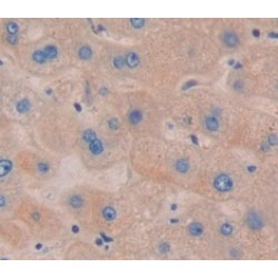 Tissue Factor Pathway Inhibitor 2 (TFPI2) Antibody