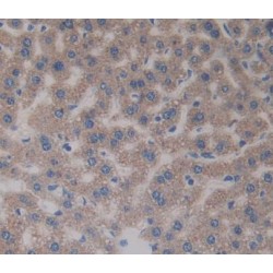 Tissue Factor Pathway Inhibitor 2 (TFPI2) Antibody