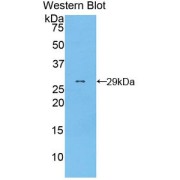 Western blot analysis of the recombinant protein.