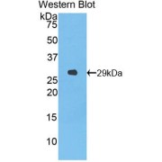 Western blot analysis of the recombinant protein.