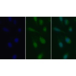 Transforming Growth Factor Beta 1 (TGFb1) Antibody