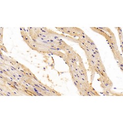 Transforming Growth Factor Beta 1 (TGFb1) Antibody