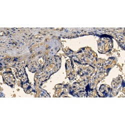 Transforming Growth Factor Beta 1 (TGFb1) Antibody