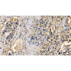 Transforming Growth Factor Beta 1 (TGFb1) Antibody