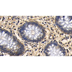 Transforming Growth Factor Beta 1 (TGFb1) Antibody