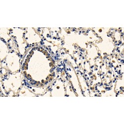 Transforming Growth Factor Beta 1 (TGFb1) Antibody