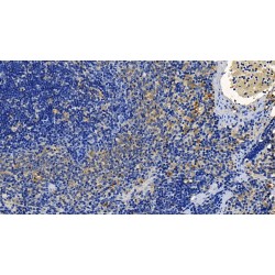 Transforming Growth Factor Beta 1 (TGFb1) Antibody