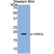 Western blot analysis of the recombinant protein.