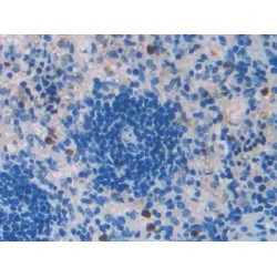 Transforming Growth Factor Beta 2 (TGFb2) Antibody