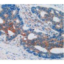 Vascular Cell Adhesion Molecule 1 (VCAM1) Antibody