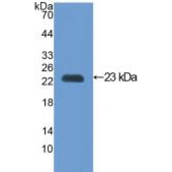 Vascular Cell Adhesion Molecule 1 (VCAM1) Antibody