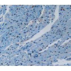 Vascular Cell Adhesion Molecule 1 (VCAM1) Antibody