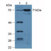 Western blot analysis of (1) Mouse Lung Tissue and (2) Mouse Kidney Tissue.