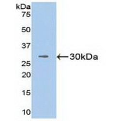 Vascular Cell Adhesion Molecule 1 (VCAM1) Antibody