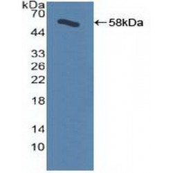 Adrenergic Receptor Beta Kinase 1 (ADRbK1) Antibody