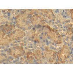 B-Cell CLL/Lymphoma 2 Like Protein (Bcl2L) Antibody