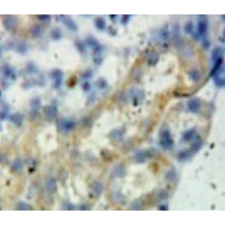 B-Cell CLL/Lymphoma 2 Like Protein (Bcl2L) Antibody