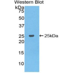 B-Cell CLL/Lymphoma 2 Like Protein (Bcl2L) Antibody