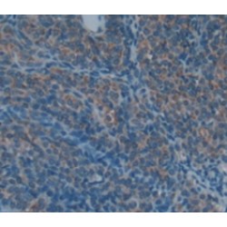 Cartilage Oligomeric Matrix Protein (COMP) Antibody