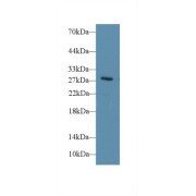 Western blot analysis of Rat Blood Cells lysate, using Rat DIO3 Antibody (1 µg/ml) and HRP-conjugated Goat Anti-Rabbit antibody (<a href="https://www.abbexa.com/index.php?route=product/search&amp;search=abx400043" target="_blank">abx400043</a>, 0.2 µg/ml).