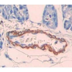 Deiodinase, Iodothyronine, Type III (DIO3) Antibody