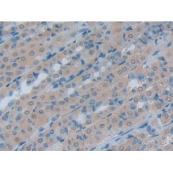 Heat Shock Protein 105 kDa (HSPH1) Antibody