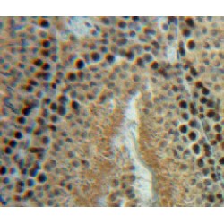 Heat Shock Protein 105 kDa (HSPH1) Antibody