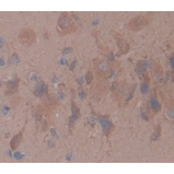 Hepatocyte Growth Factor Activator (HGFAC) Antibody