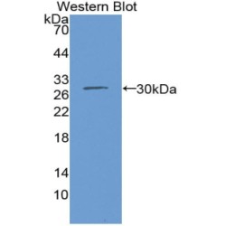 Isocitrate Dehydrogenase 1, Soluble (IDH1) Antibody