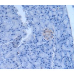 Left/Right Determination Factor 1 (LEFTY1) Antibody