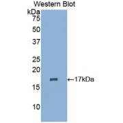 Western blot analysis of recombinant Human LIFR.