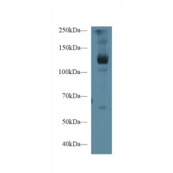 Leukemia Inhibitory Factor Receptor (LIFR) Antibody