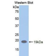 Western blot analysis of recombinant Human LIFR.